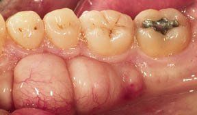 Periodontal Gallery 1