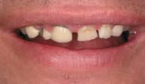 Periodontal Gallery 1
