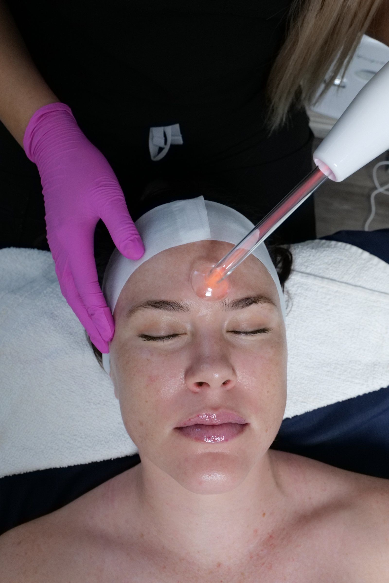 Facial treatment with gloved hand applying device to forehead on a woman lying on a treatment bed