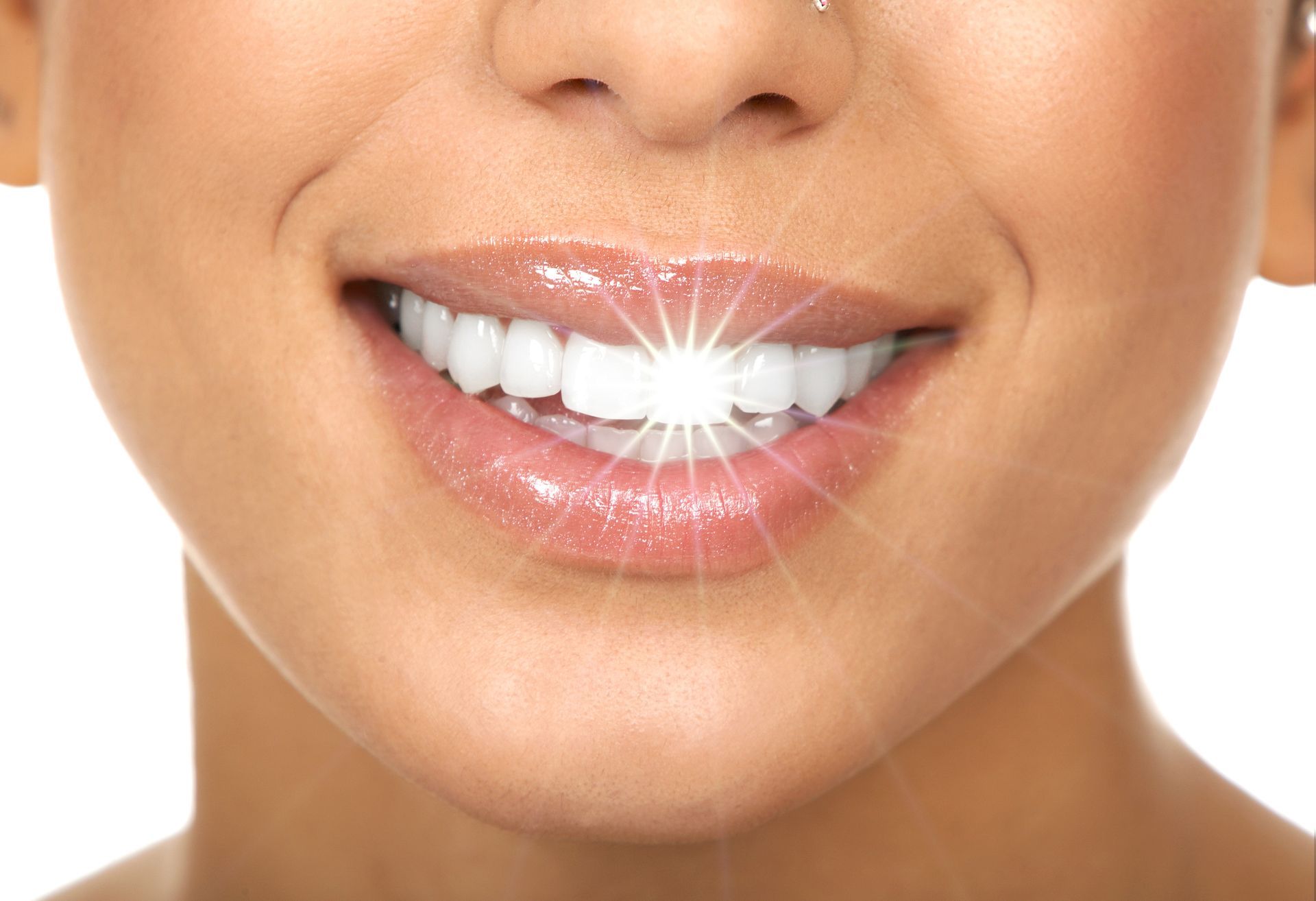 A close up of a woman 's smile with white teeth.