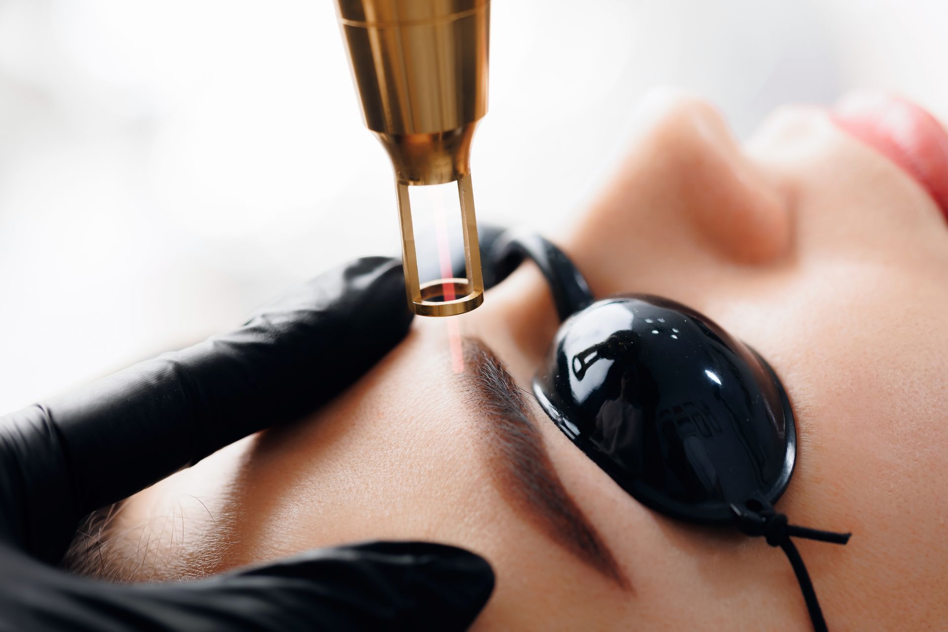 A woman is getting a laser treatment on her eyebrows.