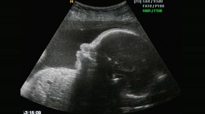 DRA YASMIN MIRANDA AGUILAR - ULTRASONIDO