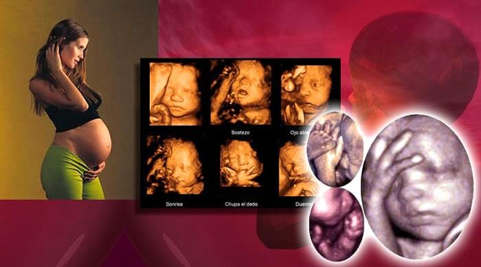 DRA YASMIN MIRANDA AGUILAR - ULTRASONIDO 4D