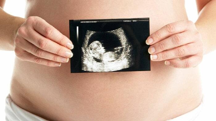 DRA YASMIN MIRANDA AGUILAR - PARTOS