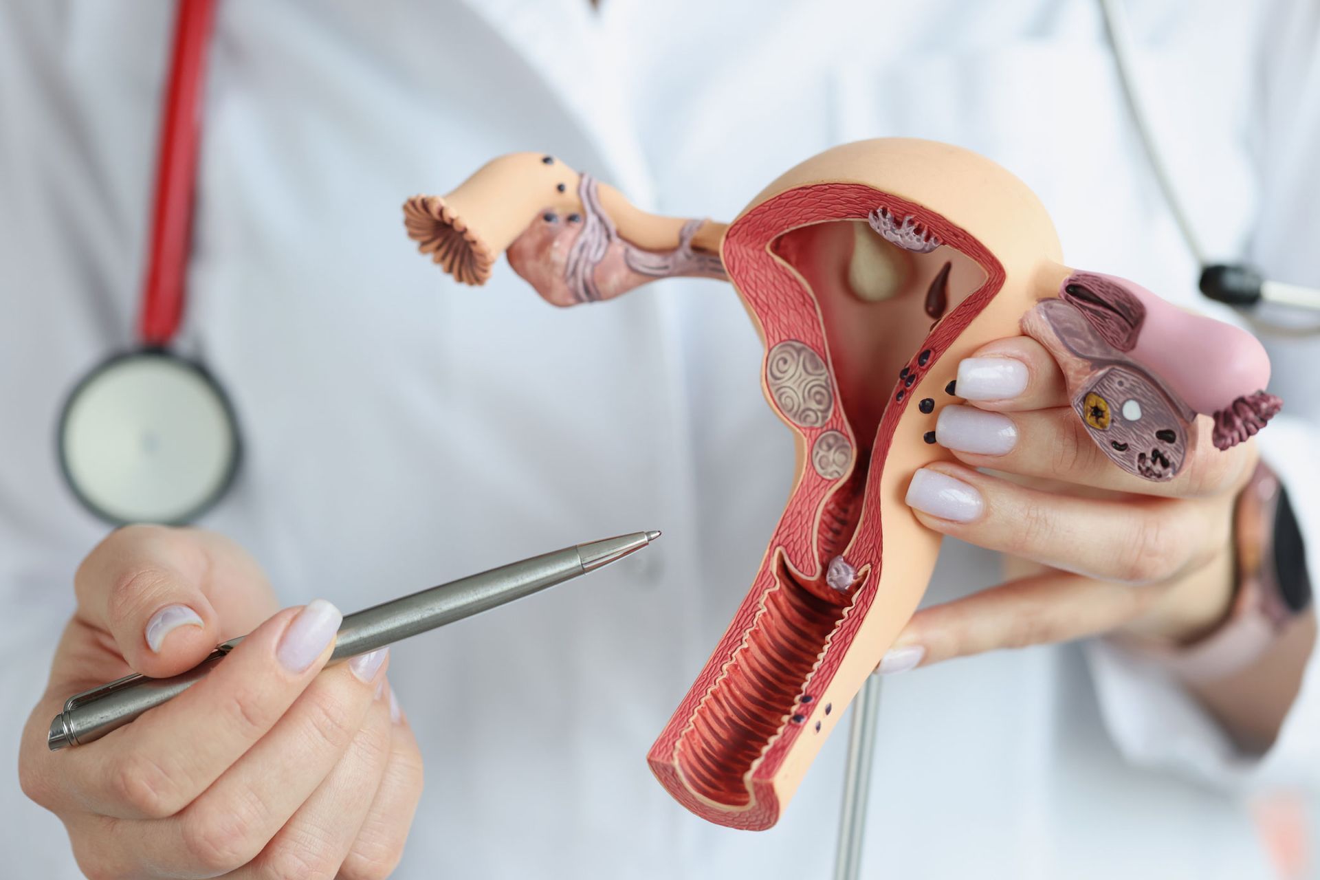 DRA YASMIN MIRANDA AGUILAR - QUISTES OVARICOS