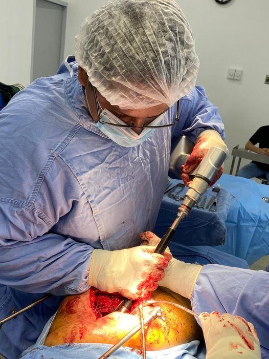 DR. DIEGO CORRAL ACOSTA - Prótesis cadera