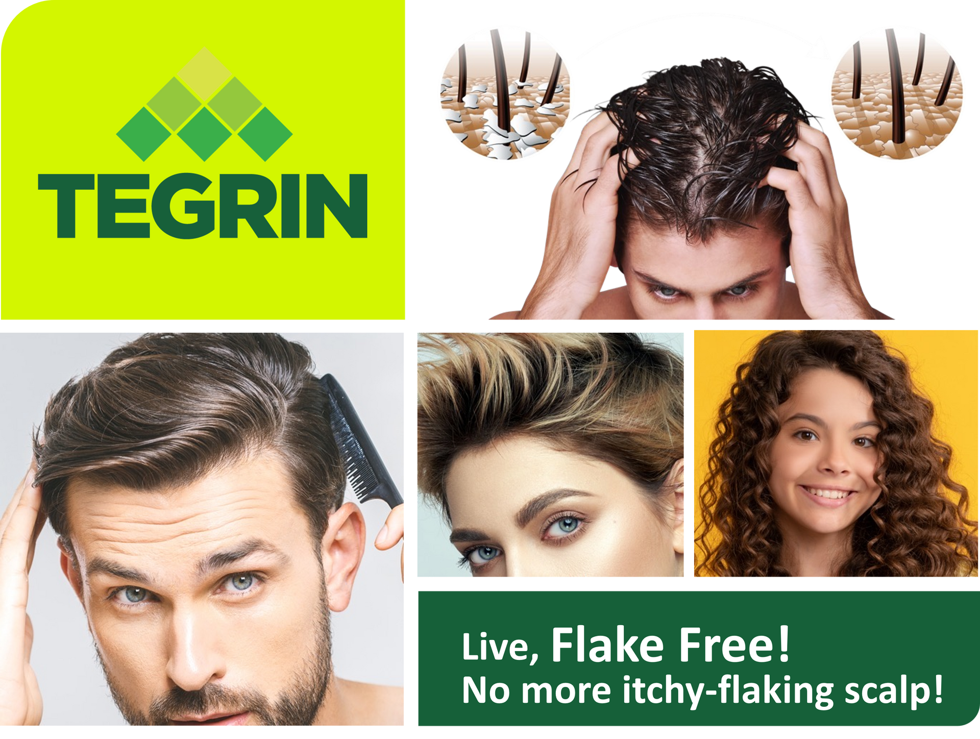 Tegrin anti-dandruff shampoo ad. Shows before/after hair images and people with healthy hair, text says 
