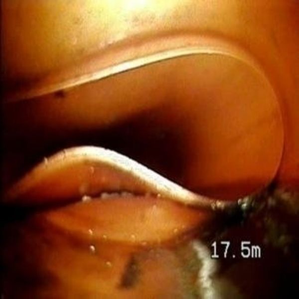 Videoispezione di fognature