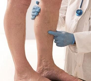 DR. DAVID F. CORRALES SÁNCHEZ – Dolor