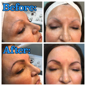 Before and after shots of microblading procedure