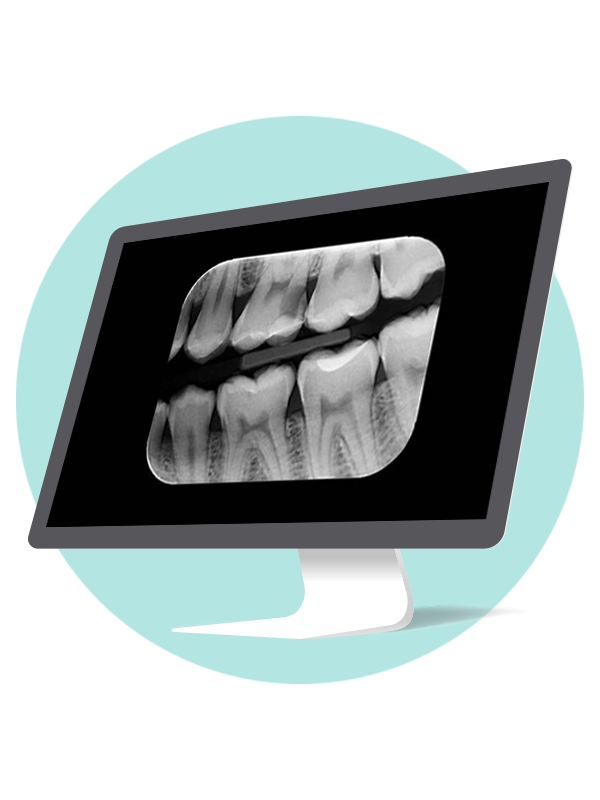 Radiologías Intraorales