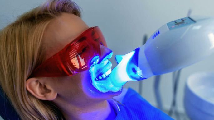 High Rollers Social teeth whitening