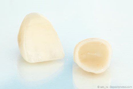 Zahnkronen aus der Zahnarztpraxis Kulemeier in Ettenheim