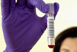 Servicios Hematológicos S.A. - AUTOTRANSFUSIÓN