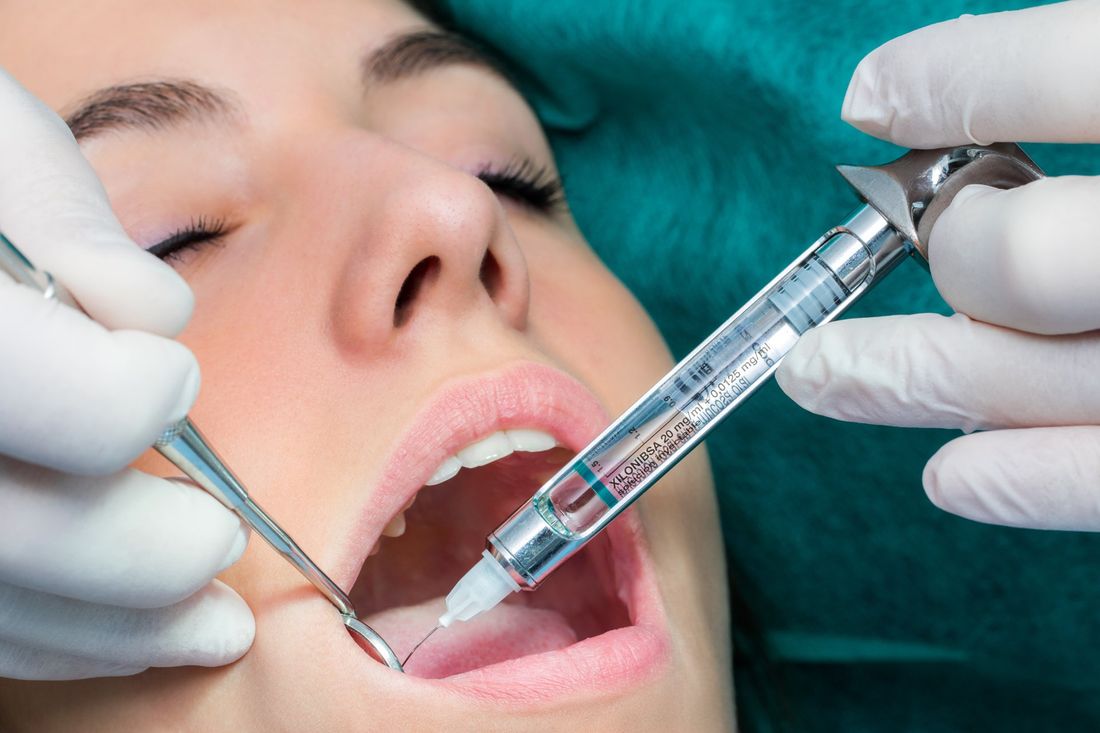 interventi di chirurgia orale