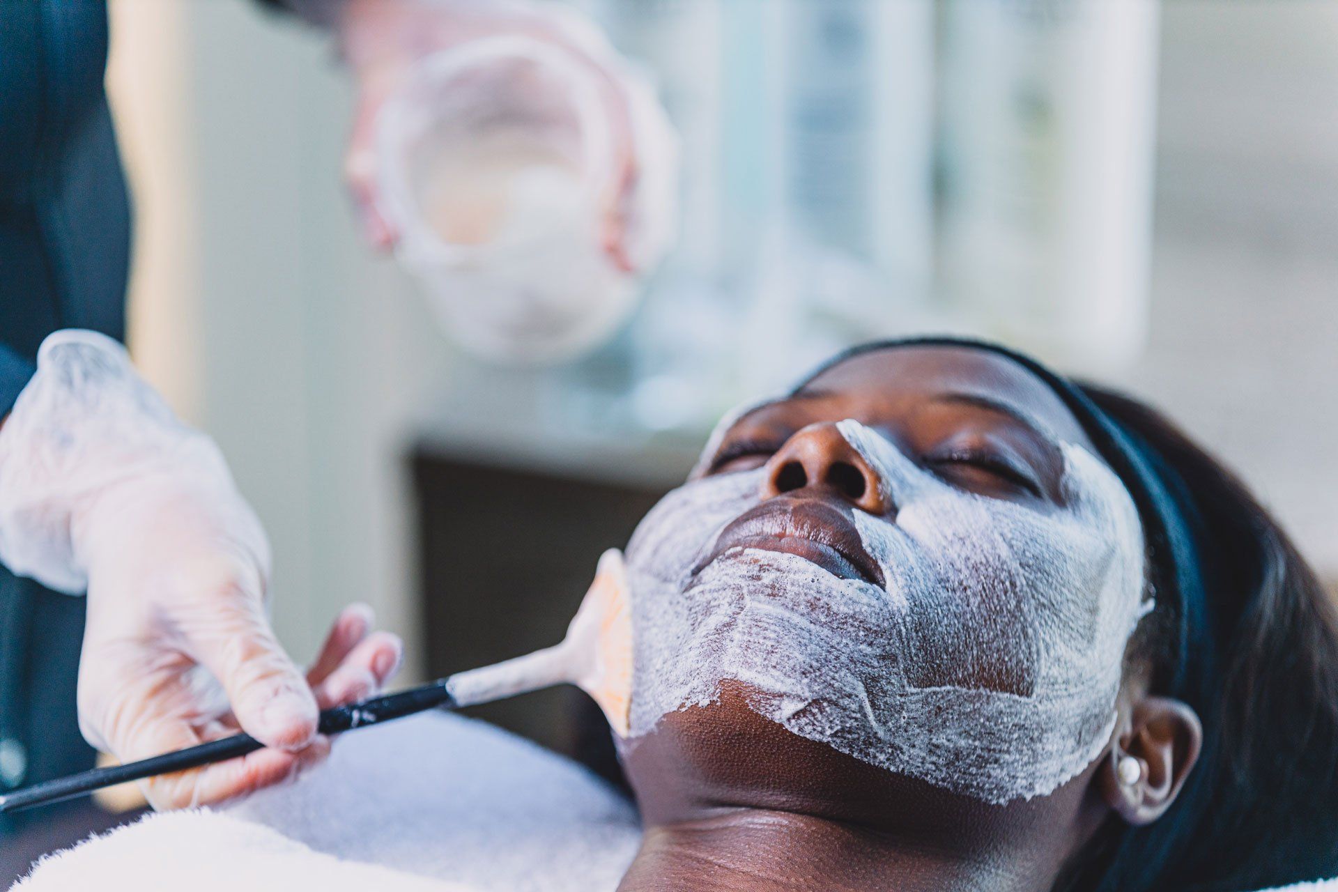 chemical peels