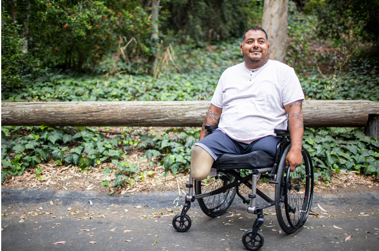 a man with a prosthetic leg is sitting in a wheelchair .