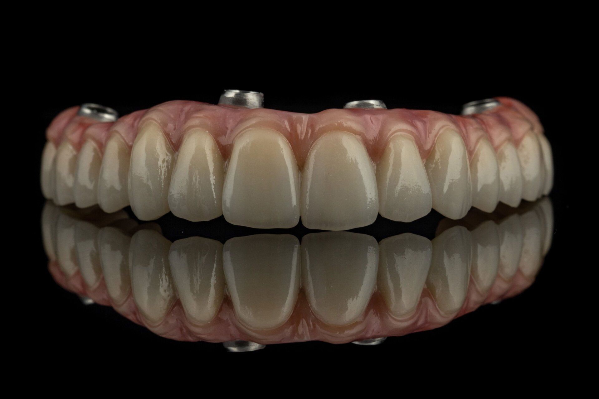 full arch implant bridges