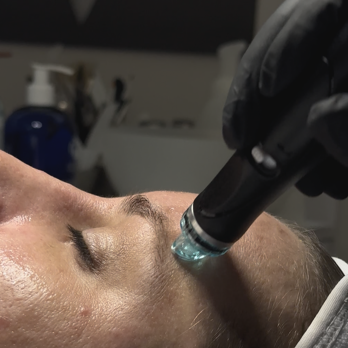 Hydrafacial Original Bern
