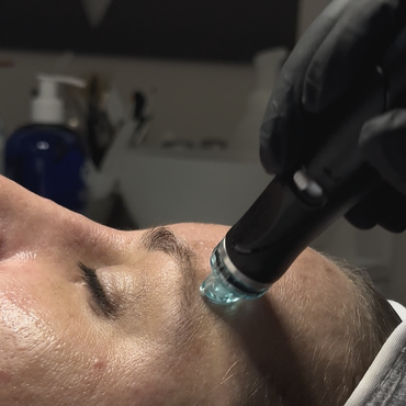 Hydrafacial Original Bern
