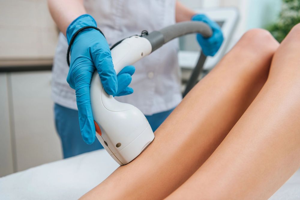 In un ambulatorio, un tecnico con i guanti blu utilizza un dispositivo laser per la depilazione sulla gamba di una paziente.