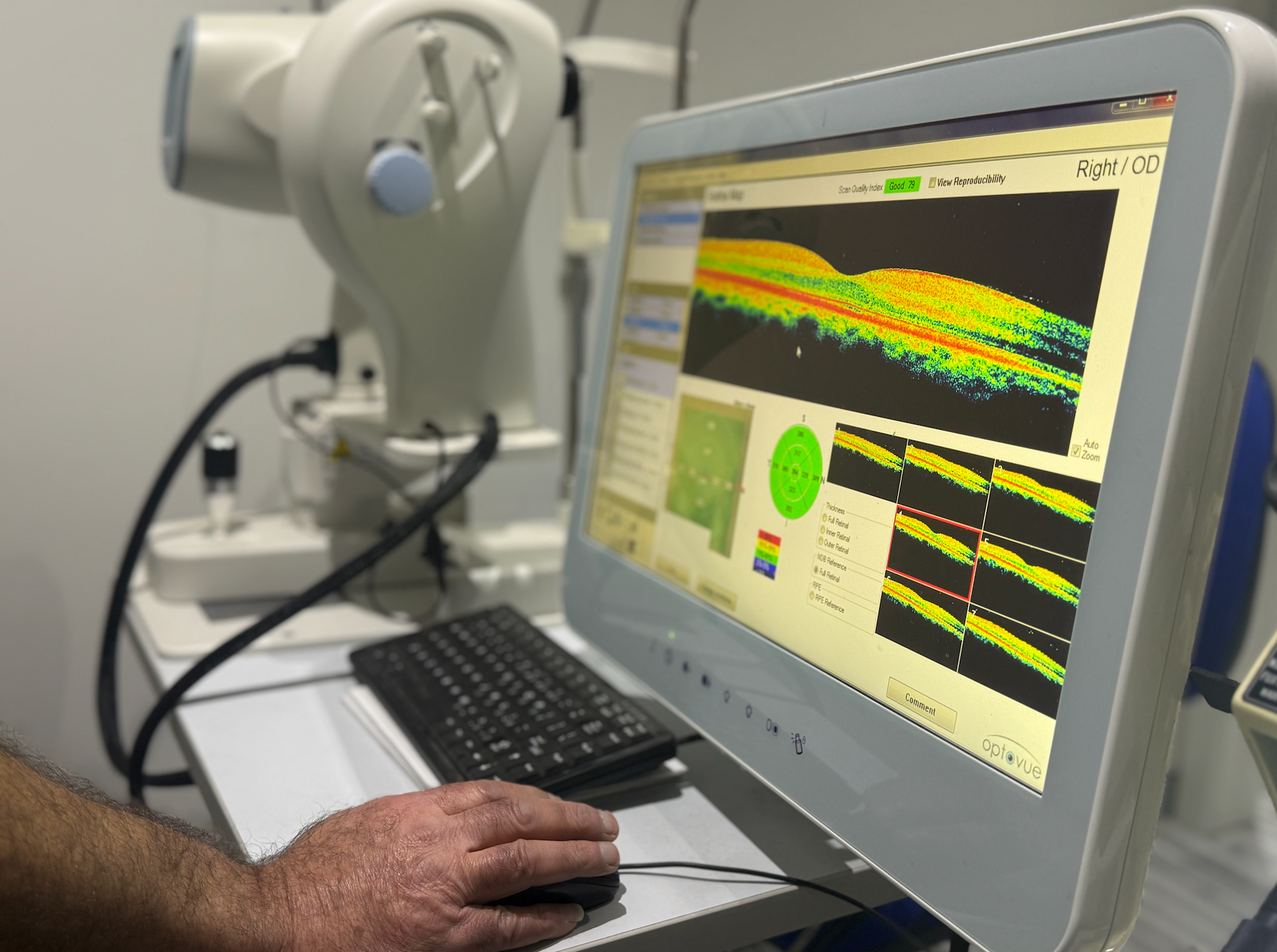 Person using an eye-scanning machine to analyse a colourful retinal scan displayed on a monitor - — Eyepower In Tahmoor, NSW