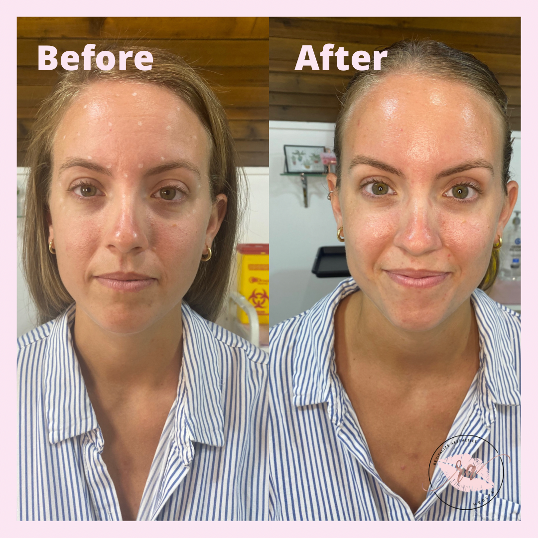 A before and after photo of a woman 's face.