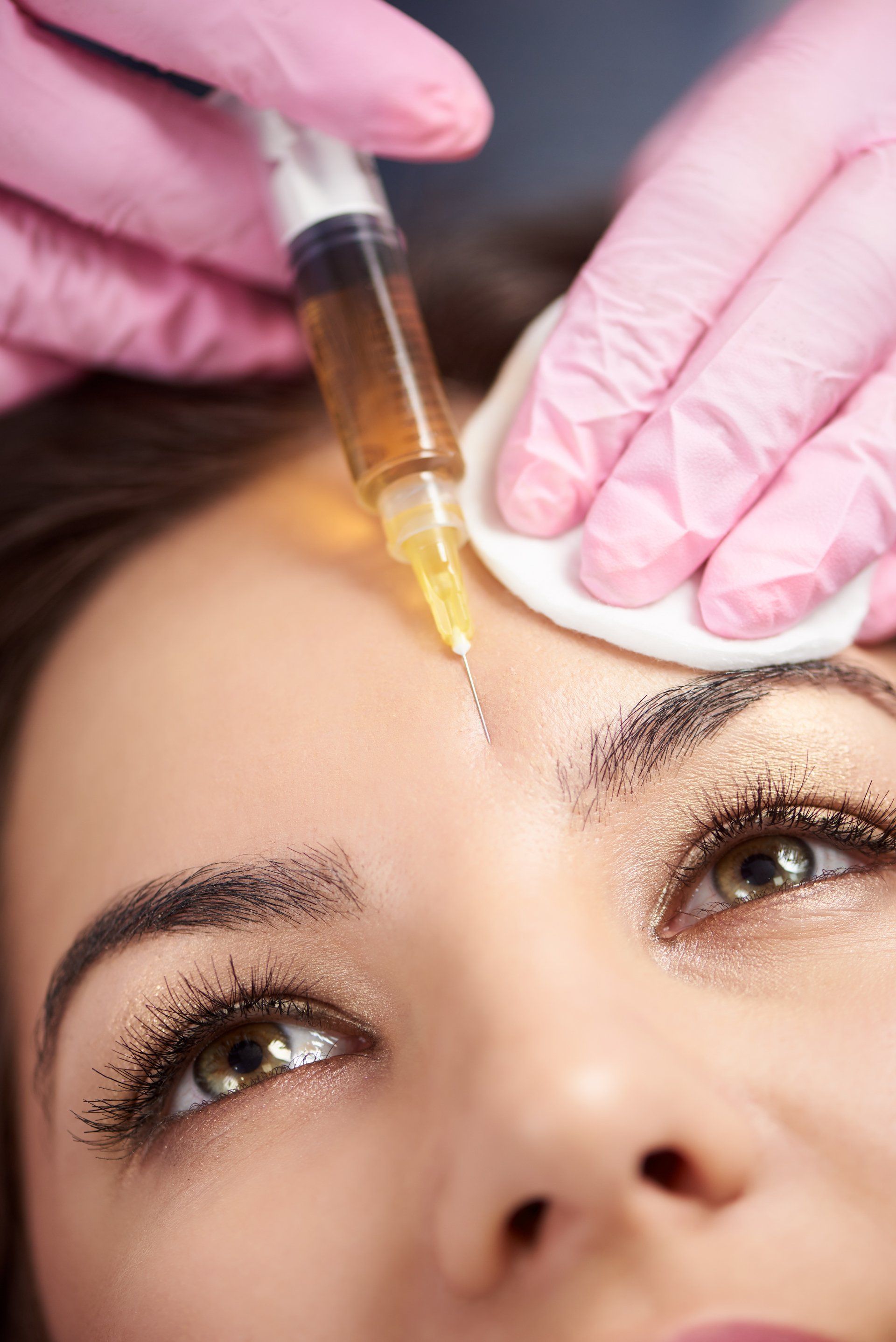 closeup of woman getting botox in between eyebrows