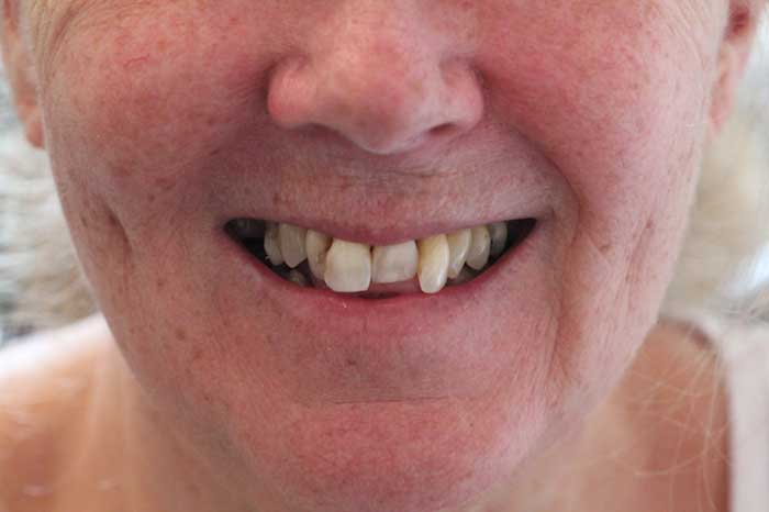 Broad Lane Dental