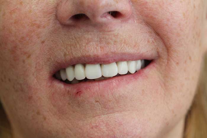 Broad Lane Dental