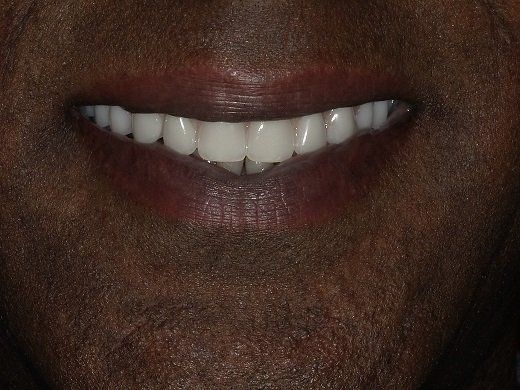 Broad Lane Dental