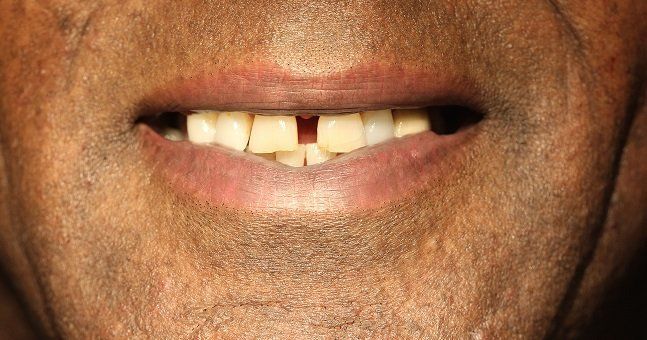 Broad Lane Dental