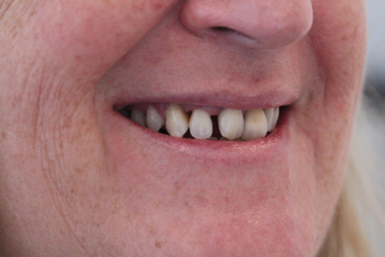 Broad Lane Dental
