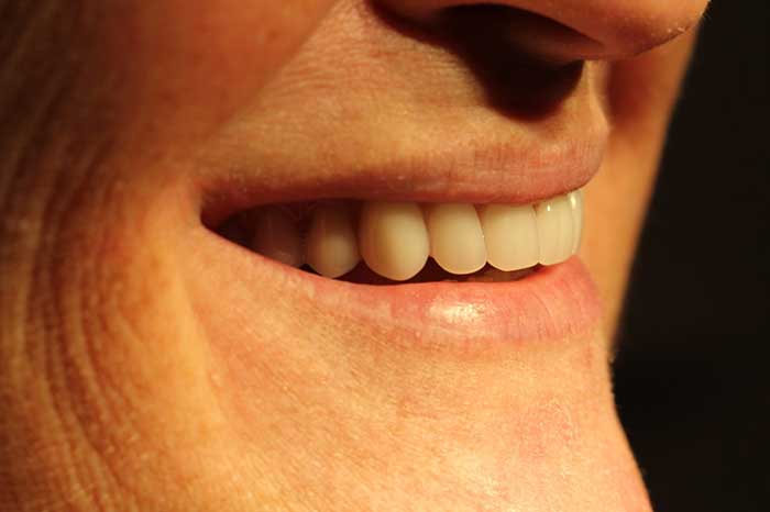 Broad Lane Dental