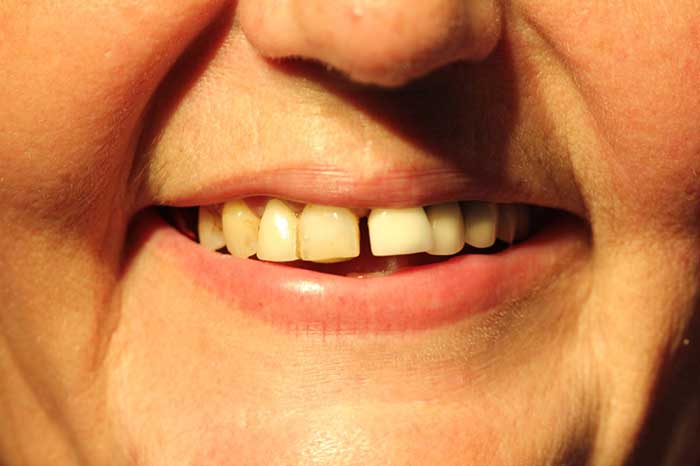 Broad Lane Dental