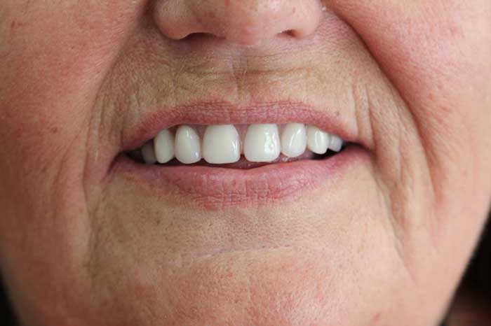 Broad Lane Dental