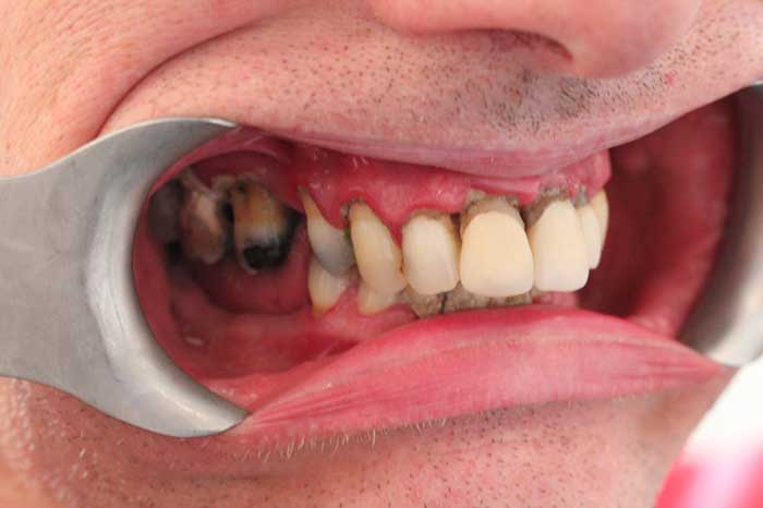 Broad Lane Dental