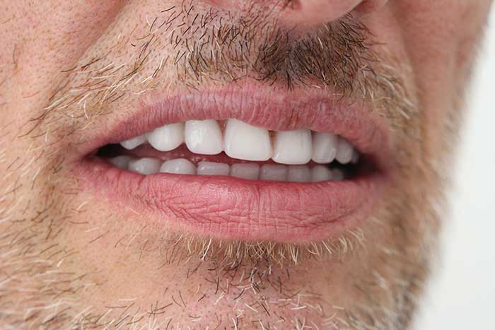 Broad Lane Dental