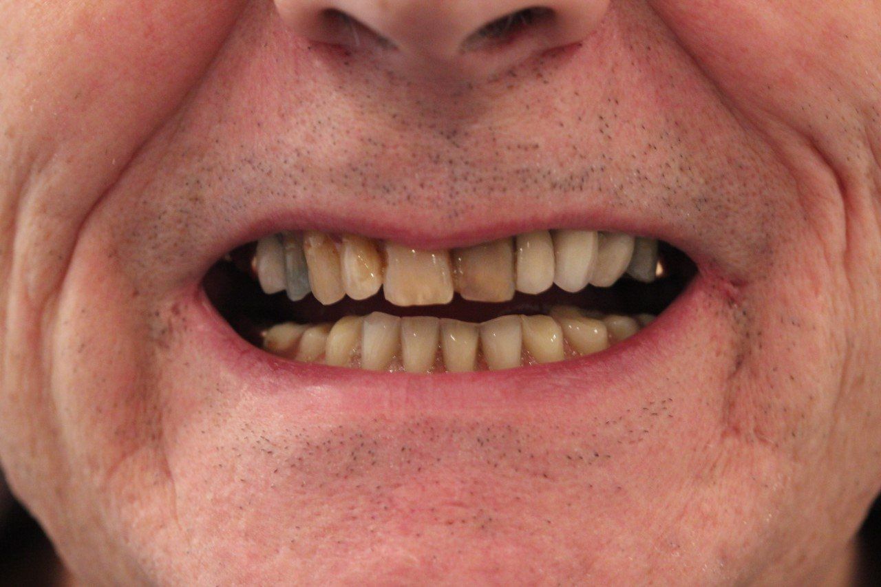 Broad Lane Dental
