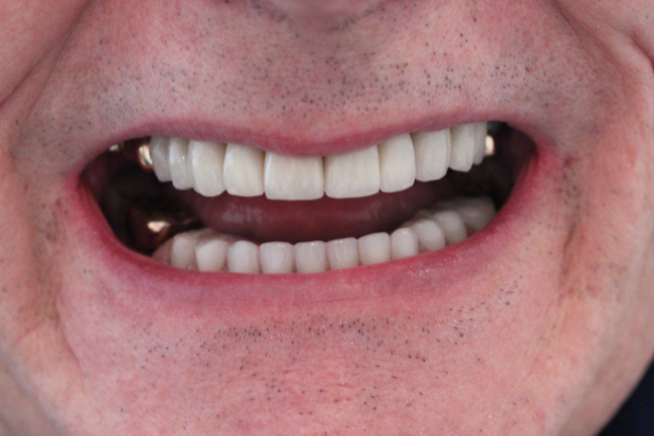 Broad Lane Dental