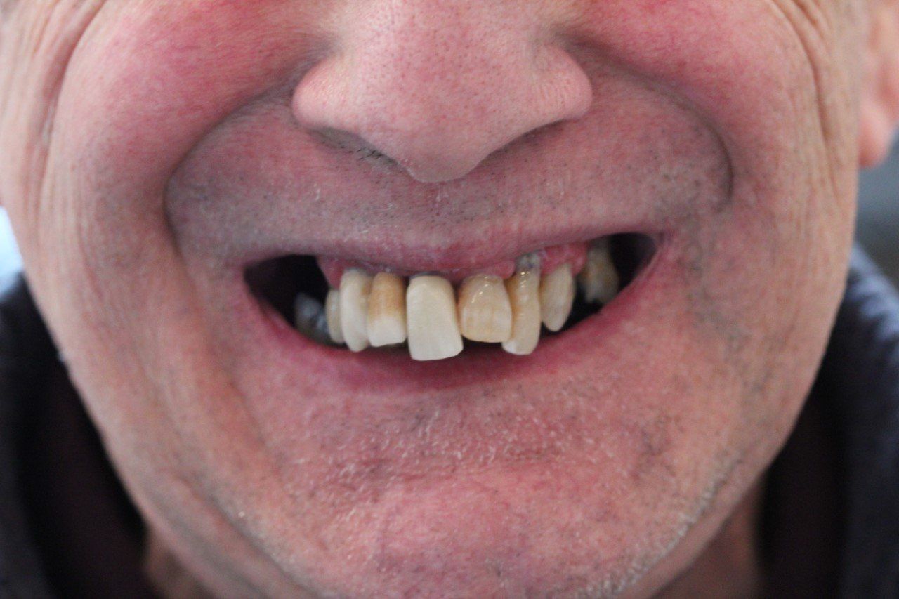 Broad Lane Dental