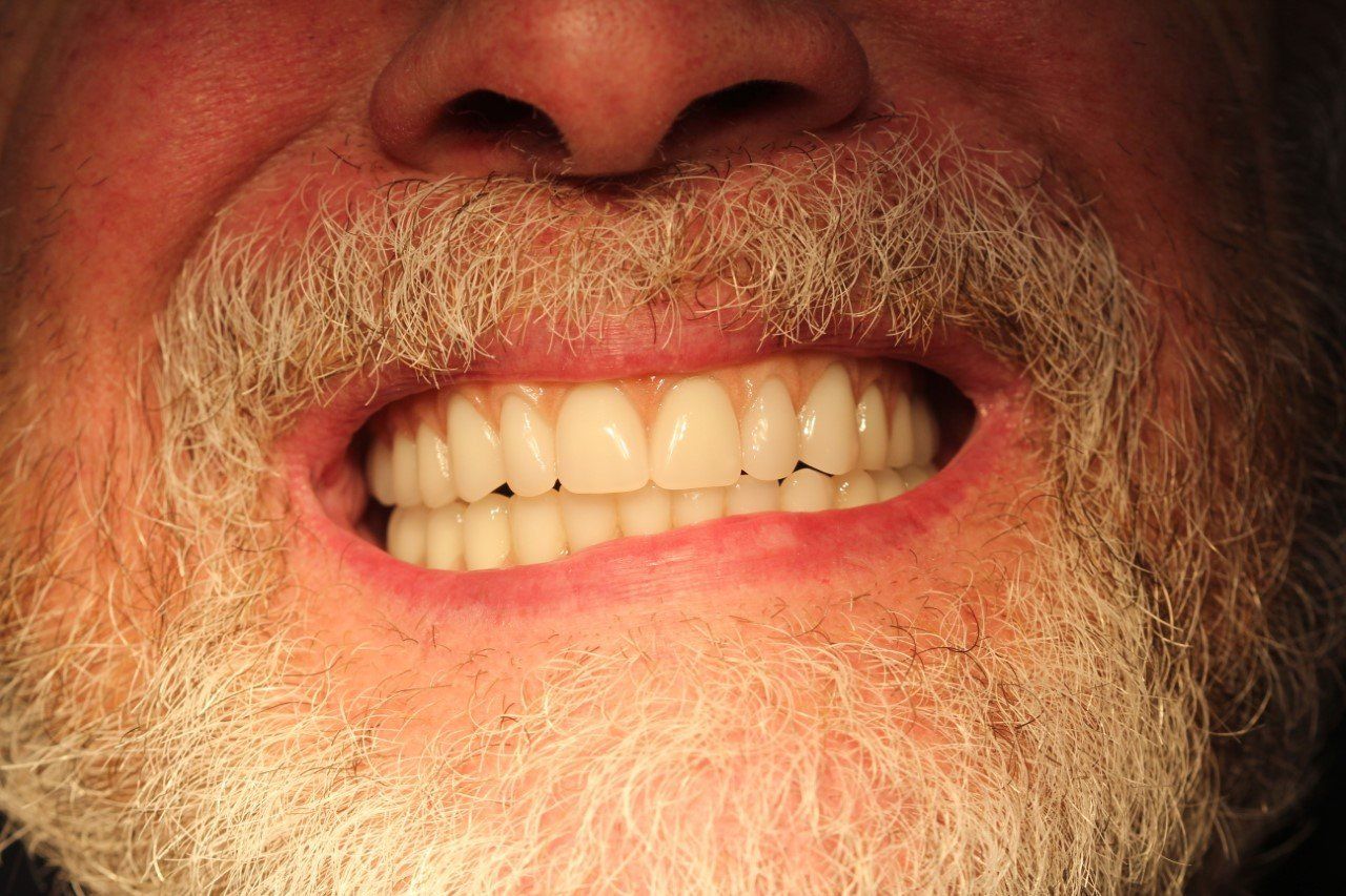 Broad Lane Dental