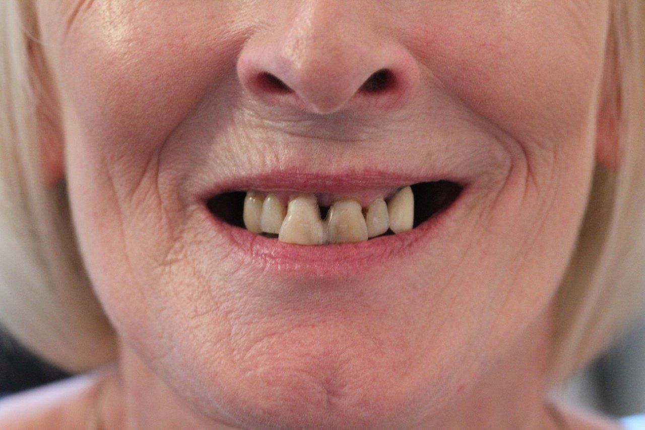Broad Lane Dental