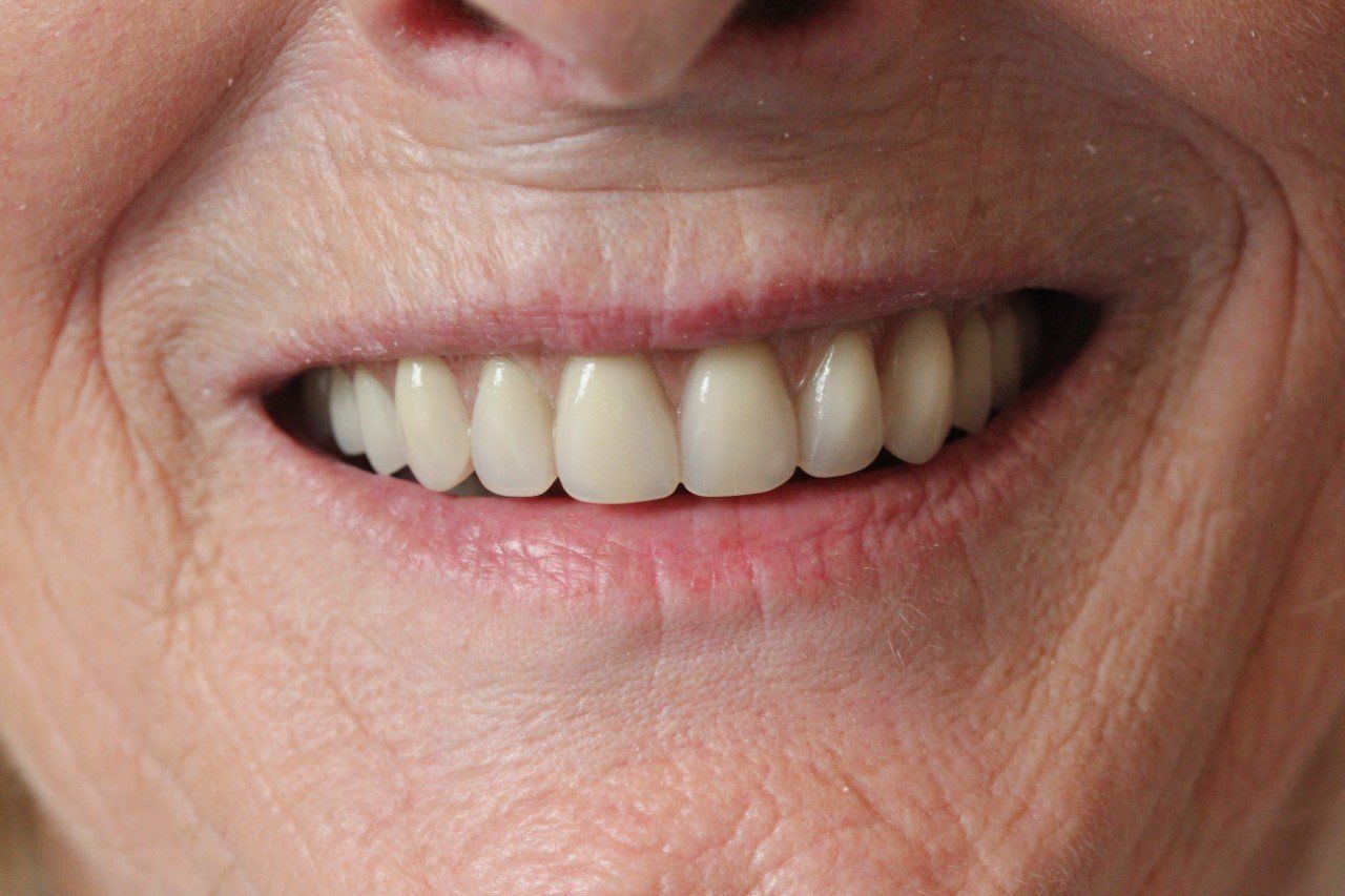 Broad Lane Dental