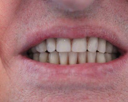 Broad Lane Dental