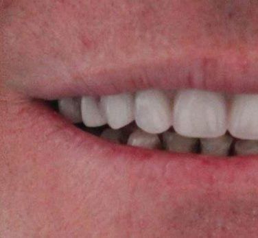 Broad Lane Dental