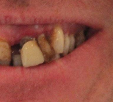 Broad Lane Dental