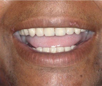 Broad Lane Dental