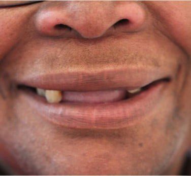 Broad Lane Dental