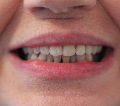 Broad Lane Dental